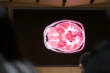 A brain scan.